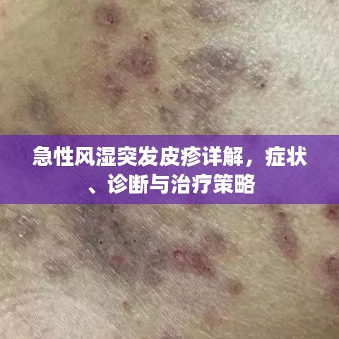 眉飞色舞